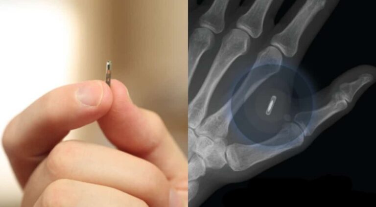Implante de biochip na mão: diga adeus para chaves e cartões de crédito