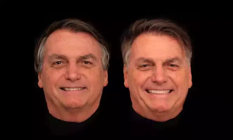 Bolsonaro faz harmonização facial e renovação dentária no valor de 84 mil reais