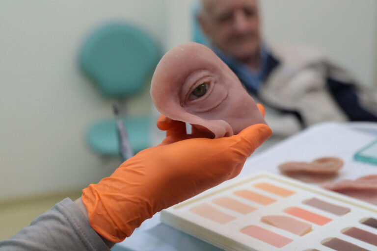 Hospital paranaense produz próteses faciais pelo SUS