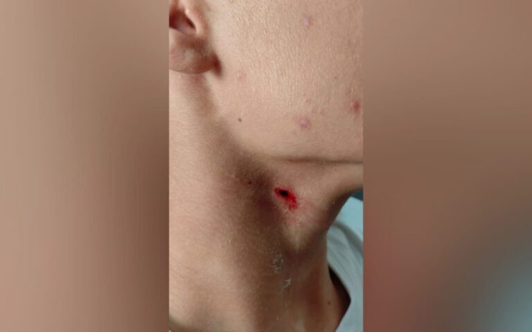Adolescente é apreendido após ataque no pescoço de colega dentro de escola em Ponta Grossa